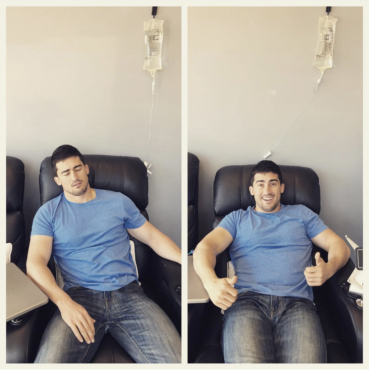 Before and after photo of a client during a hangover recovery IV drip